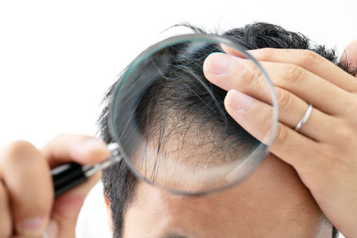 Fight thinning hair with Scalp Optic Hair